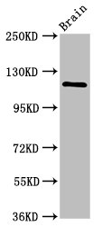 HIP1R Antibody - Positive Western Blot detected in Rat brain tissue. All lanes: HIP1R antibody at 2.4 µg/ml Secondary Goat polyclonal to rabbit IgG at 1/50000 dilution. Predicted band size: 120, 71 KDa. Observed band size: 120 KDa