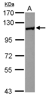 HIP1R Antibody - Sample (30 ug of whole cell lysate) A: MCF-7 7.5% SDS PAGE HIP1R antibody diluted at 1:1000