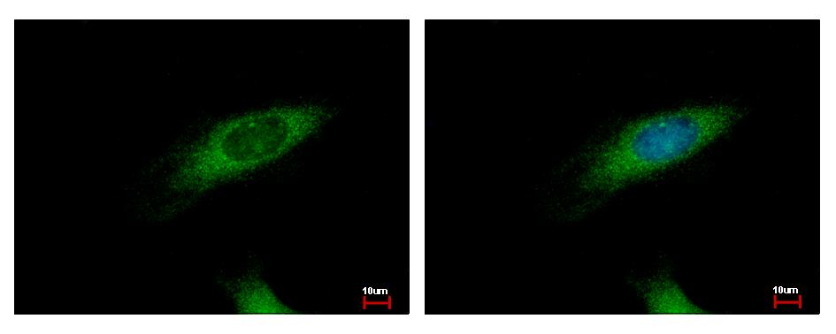 HIP1R Antibody - HIP1 Related antibody [N1N2], N-term detects HIP1R protein at cytoplasm by immunofluorescent analysis. HeLa cells were fixed in 4% paraformaldehyde at RT for 15 min. HIP1R protein stained by HIP1 Related antibody [N1N2], N-term diluted at 1:500.