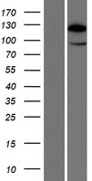 HIP1R Protein - Western validation with an anti-DDK antibody * L: Control HEK293 lysate R: Over-expression lysate