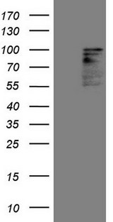 HIPK1 Antibody - HEK293T cells were transfected with the pCMV6-ENTRY control. (Left lane) or pCMV6-ENTRY HIPK1. (Right lane) cDNA for 48 hrs and lysed. Equivalent amounts of cell lysates. (5 ug per lane) were separated by SDS-PAGE and immunoblotted with anti-HIPK1. (1:2000)
