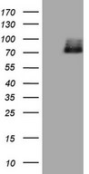 HIPK1 Antibody - HEK293T cells were transfected with the pCMV6-ENTRY control (Left lane) or pCMV6-ENTRY HIPK1 (Right lane) cDNA for 48 hrs and lysed. Equivalent amounts of cell lysates (5 ug per lane) were separated by SDS-PAGE and immunoblotted with anti-HIPK1 (1:2000).