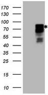 HIPK1 Antibody - HEK293T cells were transfected with the pCMV6-ENTRY control (Left lane) or pCMV6-ENTRY HIPK1 (Right lane) cDNA for 48 hrs and lysed. Equivalent amounts of cell lysates (5 ug per lane) were separated by SDS-PAGE and immunoblotted with anti-HIPK1.