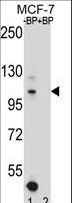 HIPK1 Antibody - Western blot of HIPK1 Antibody antibody pre-incubated without(lane 1) and with(lane 2) blocking peptide in MCF-7 cell line lysate. HIPK1 Antibody (arrow) was detected using the purified antibody.