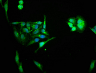 HIPK1 Antibody - Immunofluorescence staining of Hela cells at a dilution of 1:66, counter-stained with DAPI. The cells were fixed in 4% formaldehyde, permeabilized using 0.2% Triton X-100 and blocked in 10% normal Goat Serum. The cells were then incubated with the antibody overnight at 4 °C.The secondary antibody was Alexa Fluor 488-congugated AffiniPure Goat Anti-Rabbit IgG (H+L) .