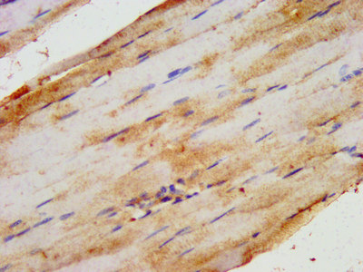 HIPK1 Antibody - Immunohistochemistry image at a dilution of 1:200 and staining in paraffin-embedded human skeletal muscle tissue performed on a Leica BondTM system. After dewaxing and hydration, antigen retrieval was mediated by high pressure in a citrate buffer (pH 6.0) . Section was blocked with 10% normal goat serum 30min at RT. Then primary antibody (1% BSA) was incubated at 4 °C overnight. The primary is detected by a biotinylated secondary antibody and visualized using an HRP conjugated SP system.