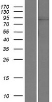 HIPK1 Protein - Western validation with an anti-DDK antibody * L: Control HEK293 lysate R: Over-expression lysate