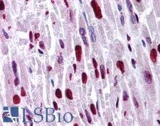 HIPK2 Antibody - Anti-HIPK2 antibody IHC of human heart. Immunohistochemistry of formalin-fixed, paraffin-embedded tissue after heat-induced antigen retrieval. Antibody concentration 5 ug/ml.  This image was taken for the unconjugated form of this product. Other forms have not been tested.