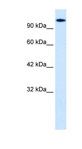 HIPK2 Antibody - HIPK2 antibody Western blot of HepG2 cell lysate. This image was taken for the unconjugated form of this product. Other forms have not been tested.