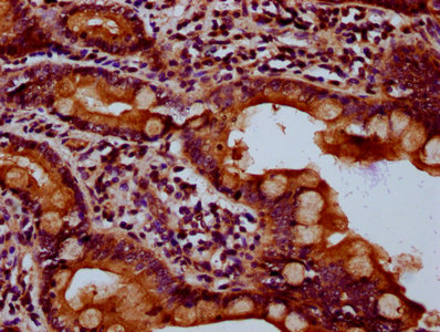 HIPK2 Antibody - Immunohistochemistry Dilution at 1:500 and staining in paraffin-embedded human small intestine tissue performed on a Leica BondTM system. After dewaxing and hydration, antigen retrieval was mediated by high pressure in a citrate buffer (pH 6.0). Section was blocked with 10% normal Goat serum 30min at RT. Then primary antibody (1% BSA) was incubated at 4°C overnight. The primary is detected by a biotinylated Secondary antibody and visualized using an HRP conjugated SP system.