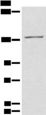 HIPK2 Antibody - Western blot analysis of 231 cell lysate  using HIPK2 Polyclonal Antibody at dilution of 1:850