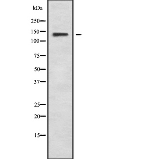 HIPK3 / FIST Antibody - Western blot analysis of HIPK3 using HepG2 whole cells lysates