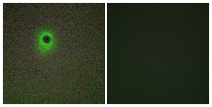 HIPK4 Antibody - Immunofluorescence analysis of A549 cells, using HIPK4 Antibody. The picture on the right is blocked with the synthesized peptide.