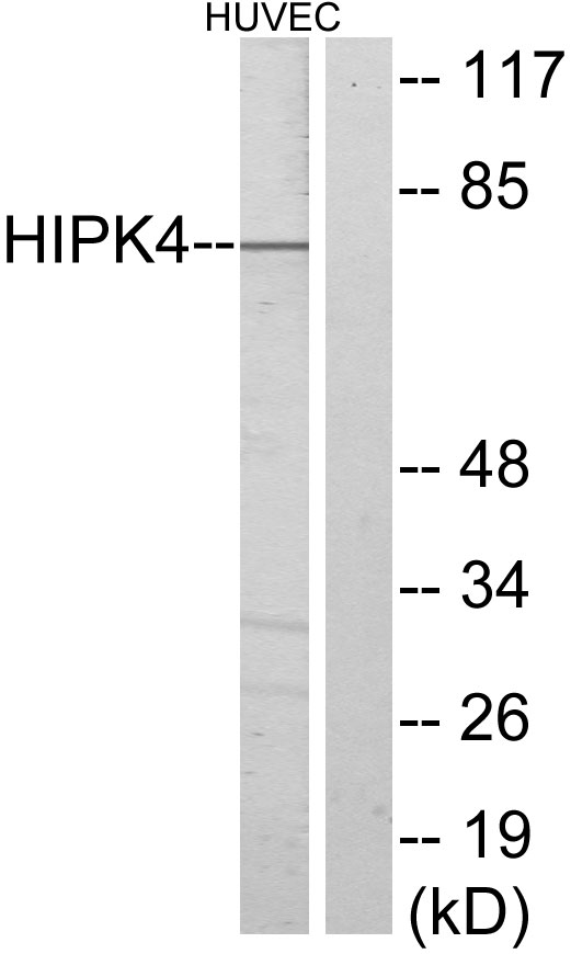 HIPK4 Antibody - Western blot analysis of lysates from HUVEC cells, using HIPK4 Antibody. The lane on the right is blocked with the synthesized peptide.
