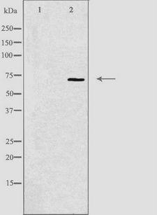 HIPK4 Antibody - Western blot analysis of extracts of HuvEc cells using HIPK4 antibody. The lane on the left is treated with the antigen-specific peptide.