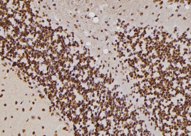 HIPK4 Antibody - 1:100 staining rat brain tissue by IHC-P. The sample was formaldehyde fixed and a heat mediated antigen retrieval step in citrate buffer was performed. The sample was then blocked and incubated with the antibody for 1.5 hours at 22°C. An HRP conjugated goat anti-rabbit antibody was used as the secondary.