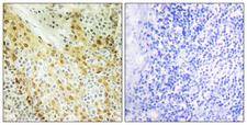 HIRA Antibody - Immunohistochemistry analysis of paraffin-embedded human tonsil tissue, using HIRA Antibody. The picture on the right is blocked with the synthesized peptide.
