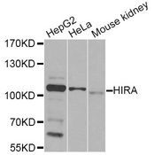 HIRA Antibody - Western blot analysis of extracts of various cell lines, using HIRA Antibody at 1:1000 dilution. The secondary antibody used was an HRP Goat Anti-Rabbit IgG (H+L) at 1:10000 dilution. Lysates were loaded 25ug per lane and 3% nonfat dry milk in TBST was used for blocking. An ECL Kit was used for detection and the exposure time was 30s.