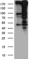 HIRA Antibody - HEK293T cells were transfected with the pCMV6-ENTRY control. (Left lane) or pCMV6-ENTRY HIRA. (Right lane) cDNA for 48 hrs and lysed. Equivalent amounts of cell lysates. (5 ug per lane) were separated by SDS-PAGE and immunoblotted with anti-HIRA rabbit polyclonal antibody.