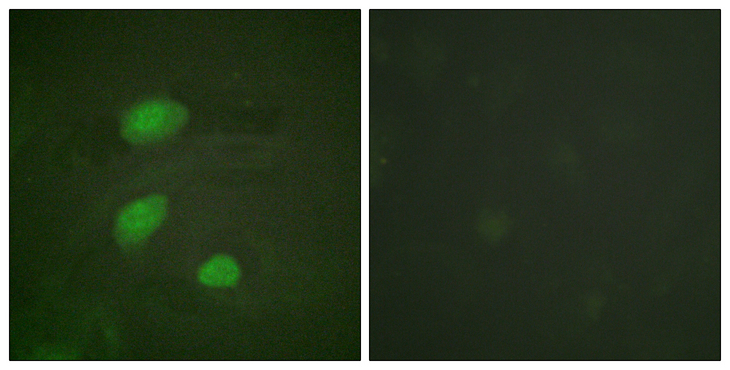 HIRA Antibody - Immunofluorescence analysis of HeLa cells, using HIRA (Phospho-Thr555) Antibody. The picture on the right is blocked with the phospho peptide.