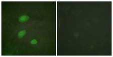 HIRA Antibody - P-peptide - + Immunofluorescence analysis of HeLa cells, using HIRA (Phospho-Thr555) antibody.