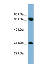 HIRIP3 Antibody - HIRIP3 antibody Western blot of ACHN lysate. This image was taken for the unconjugated form of this product. Other forms have not been tested.