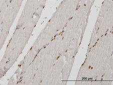 HIRIP3 Antibody - Immunoperoxidase of monoclonal antibody to HIRIP3 on formalin-fixed paraffin-embedded human skeletal muscle. [antibody concentration 0.7 ug/ml]