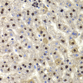 HIRIP3 Antibody - Immunohistochemistry of paraffin-embedded rat liver tissue.