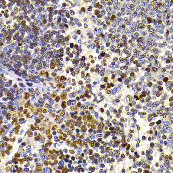 HIRIP3 Antibody - Immunohistochemistry of paraffin-embedded rat spleen tissue.