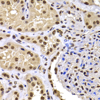 HIRIP3 Antibody - Immunohistochemistry of paraffin-embedded human kidney tissue.