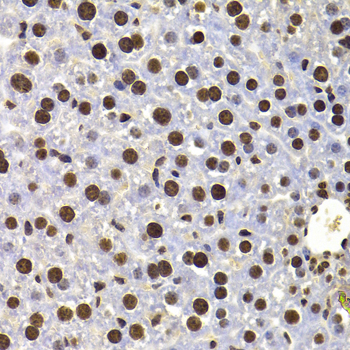 HIRIP3 Antibody - Immunohistochemistry of paraffin-embedded mouse liver tissue.