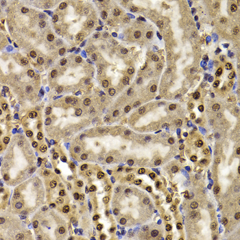 HIRIP3 Antibody - Immunohistochemistry of paraffin-embedded mouse kidney tissue.