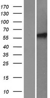 HIRIP3 Protein - Western validation with an anti-DDK antibody * L: Control HEK293 lysate R: Over-expression lysate