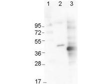 His Tag Antibody - Anti-6x-His Epitope Tag Monoclonal Antibody - Western Blot. Western blot of Immunochemicals Mouse Anti-6x-His Epitope Tag Monoclonal Antibody showing detection of the 6xHis sequence on N-terminally-tagged (lane 2) and C-terminally-tagged recombinant proteins (lane 3). In lane 1 are molecular weight markers.