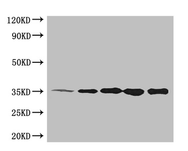 His Tag Antibody - All  Lanes: Recombinant DST Protein at 30ng/ml Line 1: Mouse Anti-his monoclonal antibody at 1:64000 Line 2: Mouse Anti-his monoclonal antibody at 1:32000 Line 3: Mouse Anti-his monoclonal antibody at 1:16000 Line 4: Mouse Anti-his monoclonal antibody at 1:8000 Line 5: Mouse Anti-his monoclonal antibody at 1:4000 Observed band size: 35kd Predicted band size: 35kd