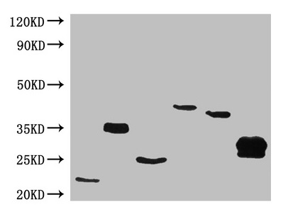 His Tag Antibody - All lanes :Mouse Anti-6*his monoclonal antibody at 1ug/ml Western blot analysis of 6*his Epitope Tag was performde by loading various amounts of lysates containing different HIS tagged Recombinant proteins per well onto a 15% Tris-HCL polyacrylamide gel. Line 1: FABP3 insect cell lysate Line 2: TK1 insect cell lysate Line 3: cagA insect cell lysate Line 4: NGAL insect cell lysate Line 5: IGFBP1 293T cell lysate Line 6: TRY2 293T cell lysate