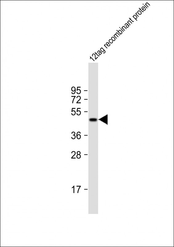 His Tag Antibody - Anti-HIS Tag Antibody at 1:2000 dilution + 12tag recombinant protein lysate Lysates/proteins at 20 µg per lane. Predicted band size: 45-50 kDa Blocking/Dilution buffer: 5% NFDM/TBST.