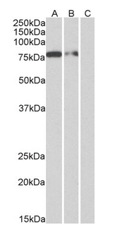 His Tag Antibody - (1 µg/ml, right panel) staining of Multitag protein at 25 ng (A), 10 ng (B) and 5 ng (C) amounts. Primary incubation was 1 hour. Detected by chemiluminescence.