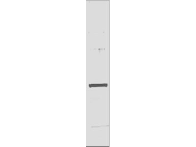 His Tag Antibody - Anti-6X His epitope tag Antibody - Western Blot. Anti-6X His epitope tag polyclonal antibody detects His-tagged recombinant proteins by western blot. Polyclonal Rabbit-anti-6X His epitope tag at 0.5-1.0 ug/ml was used to detect 1.0 ug of recombinant protein containing the His epitope tag. A 4-20% gradient gel was used to resolve the protein by SDS-PAGE. The protein was transferred to nitrocellulose using standard methods. After blocking, the membrane was probed with the primary antibody for 1 h at room temperature followed by washes and reaction with a 1:2500 dilution of IRDye 800 conjugated Gt-a-Rabbit IgG [H&L] MX10 (code for 30 min at room temperature. LICORs Odyssey Infrared Imaging System was used to scan and process the image. Other detection systems will yield similar results. This image was taken for the unconjugated form of this product. Other forms have not been tested.