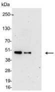His Tag Antibody - Detection of 6-His tagged protein in 200, 200, and 50ng of E. coli lysate containing tagged fusion protein with 6-His Affinity-Purified Polyclonal Antibody, HRP Conjugate diluted 1:5000.