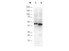 His Tag Antibody - Anti-6X His Antibody - Western Blot. Anti-6X His epitope tag polyclonal antibody detects His-tagged recombinant proteins by western blot. Polyclonal rabbit.
