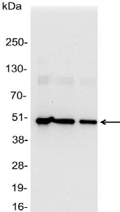 His Tag Antibody - Detection of 6-His tagged protein in 200, 100, and 50ng of E. coli lysate containing tagged fusion protein