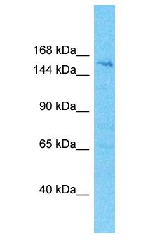 HISPPD2A / VIP1 Antibody - HISPPD2A / VIP1 antibody Western Blot of 721_B. Antibody dilution: 1 ug/ml.  This image was taken for the unconjugated form of this product. Other forms have not been tested.