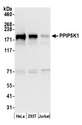 HISPPD2A / VIP1 Antibody - Detection of human PPIP5K1 by western blot. Samples: Whole cell lysate (50 µg) from HeLa, HEK293T, and Jurkat cells prepared using NETN lysis buffer. Antibody: Affinity purified rabbit anti-PPIP5K1 antibody used for WB at 0.1 µg/ml. Detection: Chemiluminescence with an exposure time of 30 seconds.