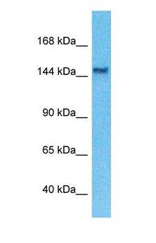 HISPPD2A / VIP1 Antibody - Western blot of PPIP5K1 Antibody with human 786-0 Whole Cell lysate.  This image was taken for the unconjugated form of this product. Other forms have not been tested.