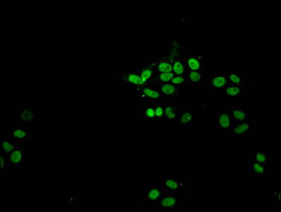 HIST1H1A Antibody - Immunofluorescent analysis of HepG2 (sodium butyrate, 30 mM, 4h) cells at a dilution of 1:100 and Alexa Fluor 488-congugated AffiniPure Goat Anti-Rabbit IgG(H+L)