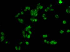 HIST1H1A Antibody - Immunofluorescent analysis of HepG2 cells at a dilution of 1:100 and Alexa Fluor 488-congugated AffiniPure Goat Anti-Rabbit IgG(H+L)
