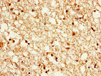 HIST1H1B Antibody - Immunohistochemistry image of paraffin-embedded human brain tissue at a dilution of 1:100