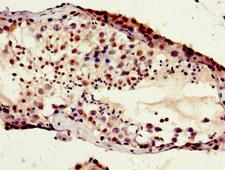 HIST1H1B Antibody - Immunohistochemistry image of paraffin-embedded human testis tissue at a dilution of 1:100