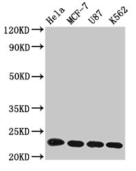 HIST1H1B Antibody - Positive Western Blot detected in Hela whole cell lysate, MCF-7 whole cell lysate, U87 whole cell lysate, K562 whole cell lysate. All lanes: HIST1H1B antibody at 1 µg/ml Secondary Goat polyclonal to rabbit IgG at 1/50000 dilution. Predicted band size: 23 KDa. Observed band size: 32 KDa